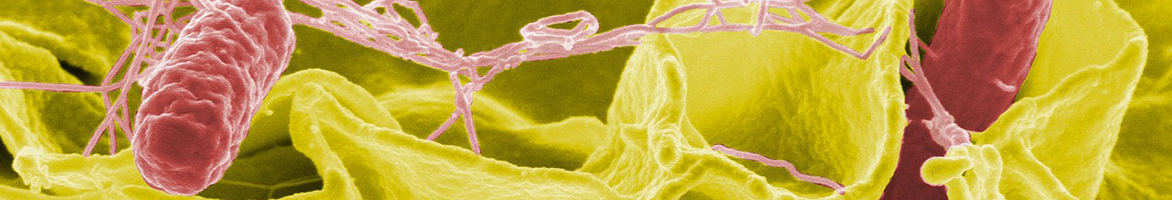 Etude des Capacités d'Adhésion de Bactéries marines sur des SURfaces innovantes par microscopie à Force Atomique 